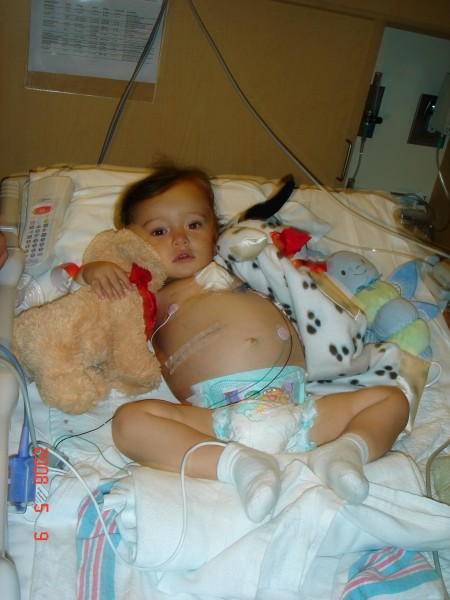 Ty on the first day he was admitted at LPCH- tumor is now visible in stomach